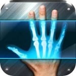تحميل برنامج اشعة x للموبايل نوكيا مجانا برابط مباشر
